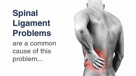 Back Ligament Injury Causes, Symptoms.